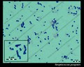 streptococcus pyogenes